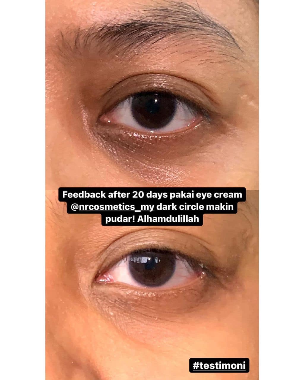 NRC - EYE CREAM NRC - EYE CREAM