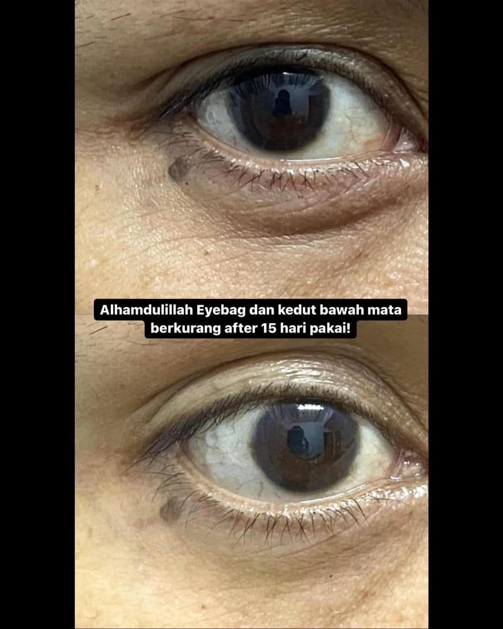 NRC - EYE CREAM NRC - EYE CREAM