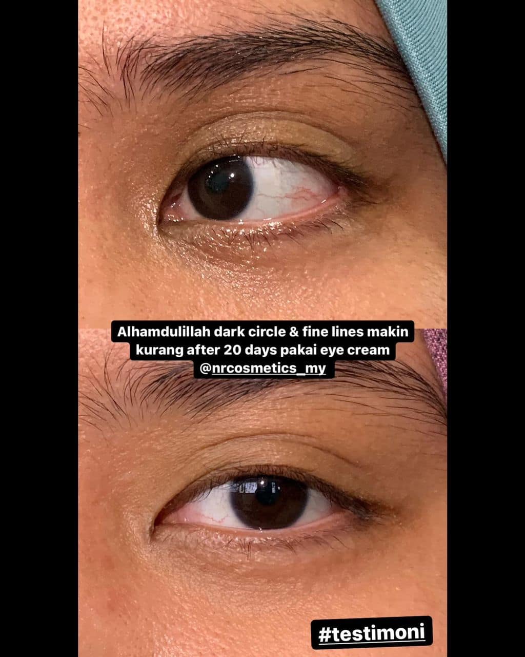 NRC - EYE CREAM NRC - EYE CREAM